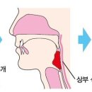 ﻿연하 구조 이미지