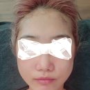 라임스킨셀