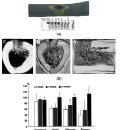 bone fracture 후 regeneration and remodeling을 위한 최적의 자극은? 이미지