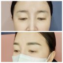 명지헤어라인