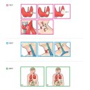 갑상선암 이미지