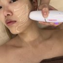 당감동 에스테틱 더지유에스테틱 하이푸리프팅 전후