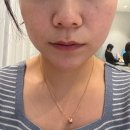 사하중앙병원 | 사하구피부과 입술필러 2cc+입꼬리 보톡스 솔직후기