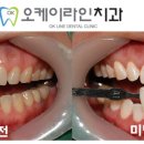 오케이라인치과 이미지