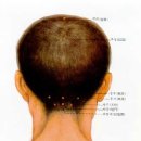 두경 이미지