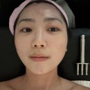 해리스힐 | 과천 거북목케어 해리스 뷰티랩 림프순환 테라맵 후기