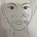 오름메디 이미지