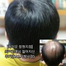 거산메디칼 | [하이모 창원지점] 최**고객님 젊어지신 후기(feat.왕좌의게임)