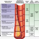 와우히어링 | 노인성난청의 원인과 예방 그리고 대처 방안 - 분당보청기히어링케어