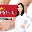 당뇨발가락 등 괴사까지 이어질 수 있는 당뇨합병증 증상, 관리 및 치료방법 등 알기 이미지