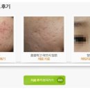 채움한의원 네이버블로그
