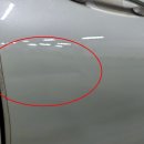 덴트 이미지