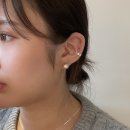 창원 피부과 볼뉴머 리프팅 300샷 전후 비교 솔직후기