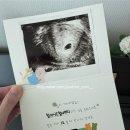 로쉬여성의원 | [임신기록] 쌍둥이 임신 초기증상 (feat. 12주차 성별 공개) &amp; 내돈내산 임밍아웃 카드 추천