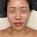 피오니 스킨 앤 바디 이미지