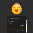 브이앤엠제이(V&MJ)피부과의원 | V&amp;MJ 피부과 써마지랑 리쥬란 후기, 지인소개 추가 할인 , 내돈내산 추천, 1주차 후기