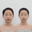 죽이야기 대구신월성점 | 대구신부관리 물오른피부 신월성점, 윤곽관리 후기