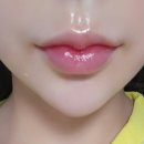 글래드성형외과의원 | 대구 입술필러 후기 글래드성형외과 리터치 후기