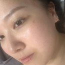 피부애 - 동구 율하동 | 울산 동구 피부관리 피부애 물광 탄력 기기관리 후기