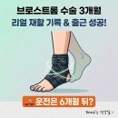 광주시 참조은병원 | (발목인대)브로스트롬 수술 3개월 후기: 재활 타임라인과 출근 가능 시기 (feat. 운전은 6개월?)