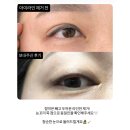 블리즈미 | 세종시 아이라인문신 제거 후기는 “대평동 블리즈미”에서