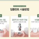 이포유#