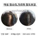 모채움스칼프