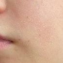 피부를 말하다 이미지