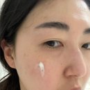 피부장벽강화제 [닥터원진 닥터토비아 연고형 재생크림] 이지에프 연고 효과 후기