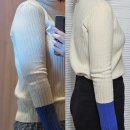 동산약국 | 신사 팔뚝 무한 람스 4주차 후기 및 Q&amp;A( 붓기, 멍, 바본, 오렌지케어,꿀팁)