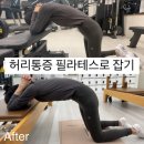 사파동247 | 사파동피티 허리통증 필라테스로 잡기