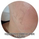 구리다산자동차공업사 | 다산피부관리 더마메디스킨케어 환절기 스킨플래닝 후기