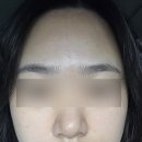 씨유 전주효자플러스점 | 전주 효자동 피부관리 임서영에스테틱 후기