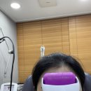 삼일한방사우나 | 내돈내산 미간주름 보톡스 후기!