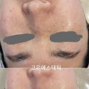 고은 에스테틱 이미지