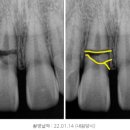 온의동치과? 15년차 의사 양심진료 솔직한 생각 &lt;상담전 필독&gt;