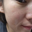 블랙로터스 | 여름철 모공·피지 고민 한 번에! 더퓨어로터스 오일투폼클렌저 사용 후기