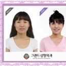 윤곽