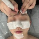 평택 소사벌 피부관리 홍조피부 진정관리 후기[유니뷰티]