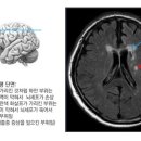 얼굴 미인보다 뇌 미인이 되라 이미지