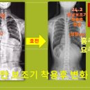 우리메디칼보조기 이미지