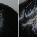 서울아트피부과의원 이미지