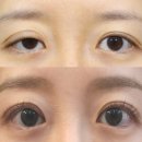 디비성형외과의원 이미지