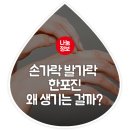 손가락발가락 이미지