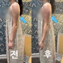 제12회 광주합창제 | 광주웨딩관리 만족했던 365메디스킨 광주본점 후기