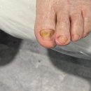 푸스케어 롯데마트제천점 이미지