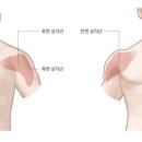 달라진피트니스