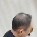민재가발 이미지
