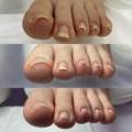 바미네일 레푸스 용인중앙점