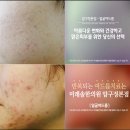 내각한의원 네이버블로그